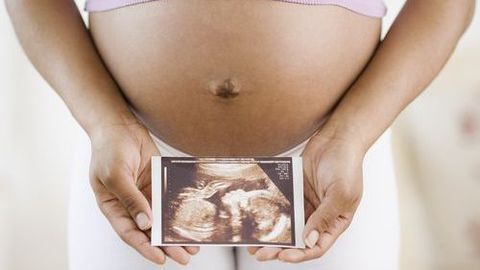 准妈妈如何分辨分娩信号？